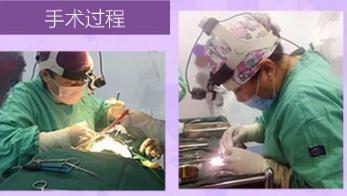 广州雅度医学美容手术过程