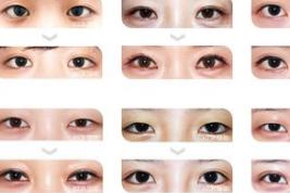 韩国nplus整形外科各种眼型