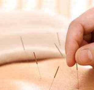 榛雅姿有助于调节体脂针灸有助于调节体脂法