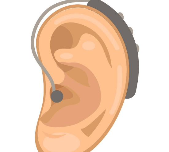 康聆声助听设备品质
